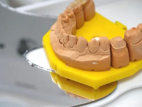 Dental model and mirror in tooth style laying on a white table Stock Photos