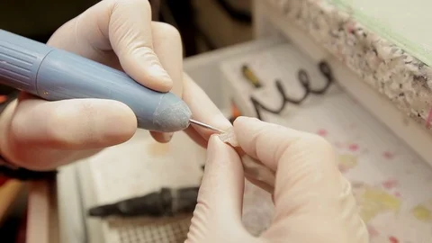 A dental model a prosthesis for teeth. About the dentist Stock Footage 71586707