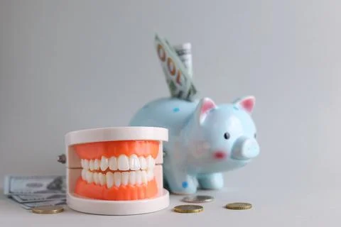 Dental model of teeth and money. The price of dental services. Foto stock