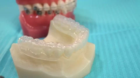 Dental Models and Braces Stock Footage 314521003