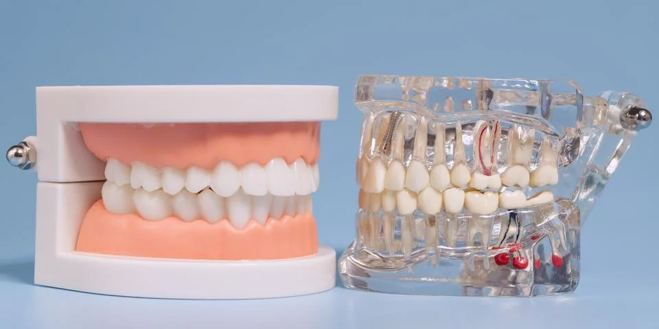 Dental models showcasing teeth structure and anatomy Stock Photos
