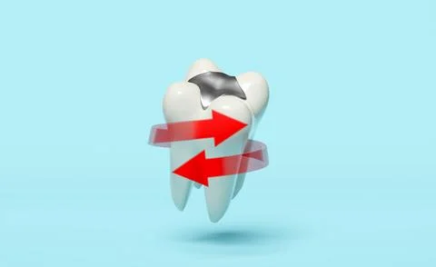 Dental molar teeth model 3d icon with red spiral arrow, filling material is.. Ilustração Stock