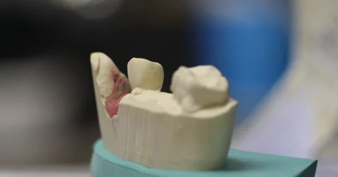 Dental Mold Close Up Forward Stock Footage 62768144