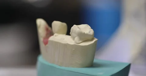 Dental Mold Close Up Move Back Stock Footage 62768049