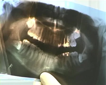 Dental office Stock-Footage 10766241