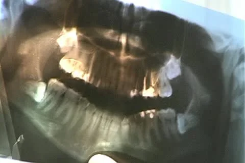 Dental office 스톡 동영상 10766242