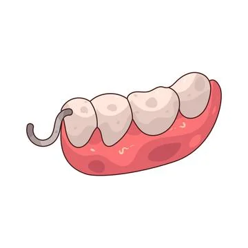 Dental Partial illustration Stock Illustration