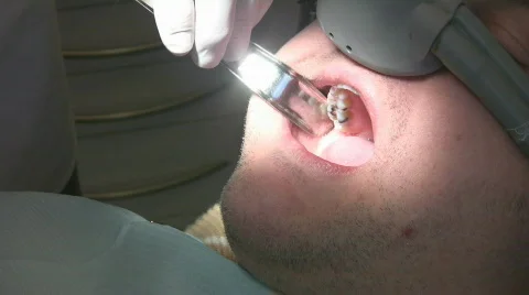 Dental patient gets injection. Stock Footage