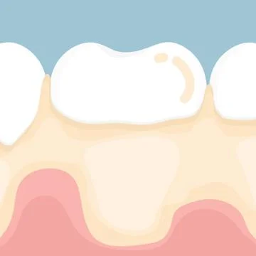 Dental plaque vector design Stock Illustration