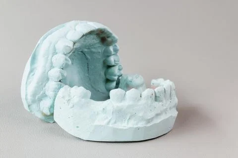 Dental Plaster Model of Teeth and Gums Foto stock
