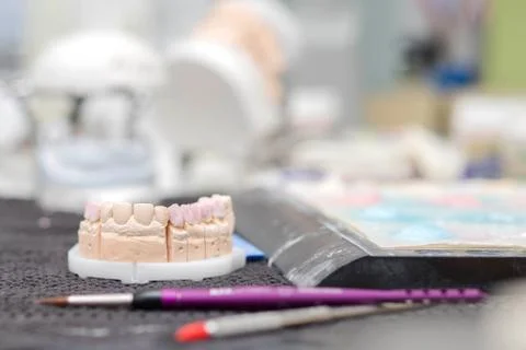 Dental plaster stone model work of making a bridge and crowns in progress Stock Photos