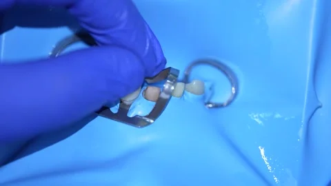 Dental Procedure with Artificial Teeth Stock Footage 316917310