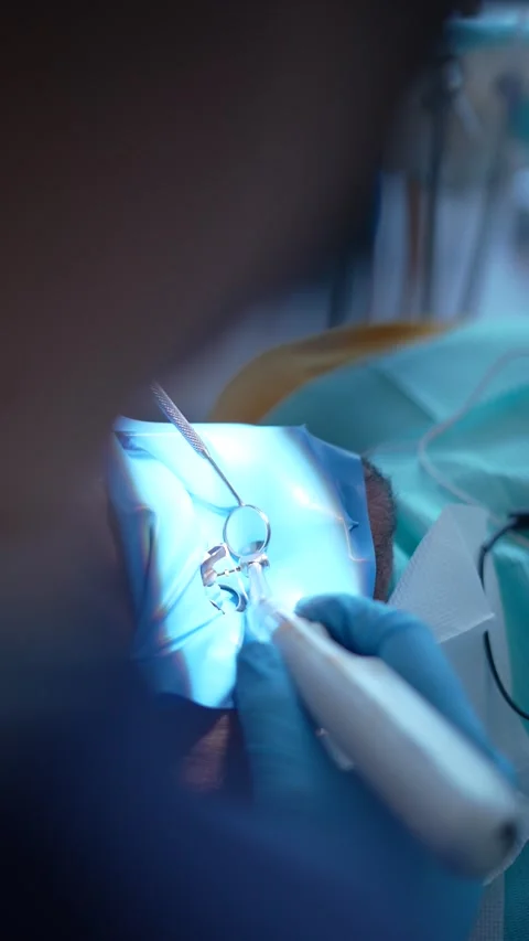 Dental Procedure Close-Up Stock Footage 316916436