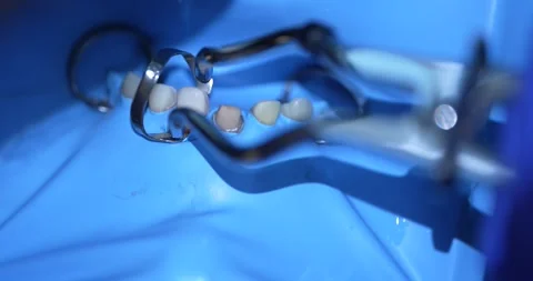 Dental Procedure Close-Up Video stock 316916897