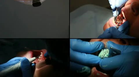 Dental procedure composition Stock Footage 10861223