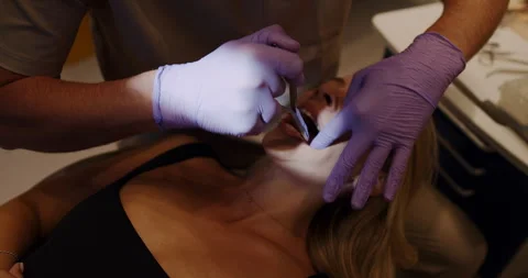 A Dental Procedure is currently in progress with the patient seated comfortably Stock Footage 318280603