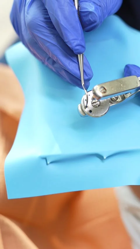 Dental Procedure Stock Footage 316914566