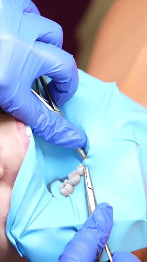 Dental Procedure Stock Footage 316914926