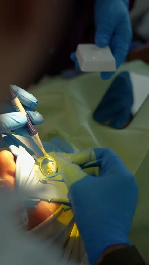Dental Procedure Insight Stock Footage 311936152