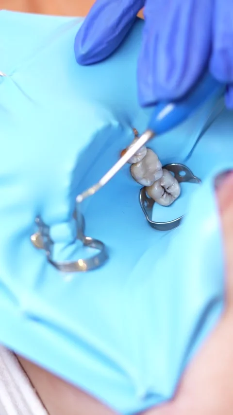 Dental Procedure with Model Stock Footage 316915117