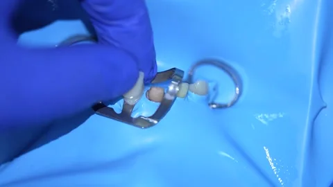 Dental Procedure with Tools Stock Footage 316917287