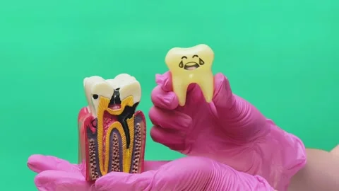 Dental Professional Comparing Decayed Molar Anatomy with Painful Tooth Model Stock Footage 337106376