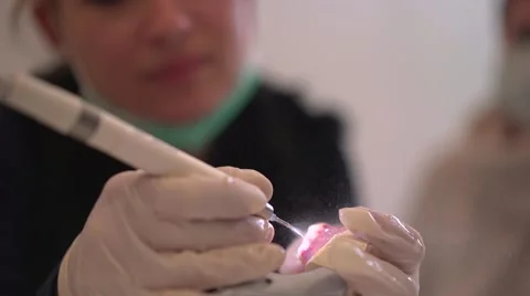 Dental Prophylaxis on custom Teeth Vídeos de archivo 66309783