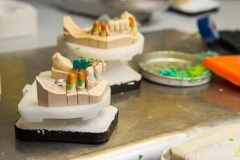 Dental prostheses Stock Photos
