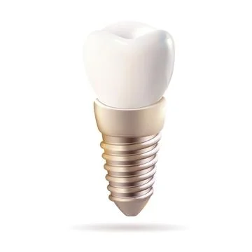 Dental prosthesis, 3D vector, realistic. Dental prosthetics Stock Illustration