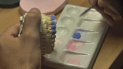 Dental prosthesis, artificial tooth, prosthetic, hands working on the denture Stock-Footage 95841703