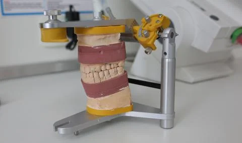 Dental prosthesis casts. Stock Photos