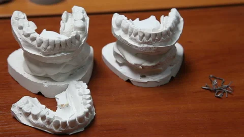 Dental prosthesis, dentures, prosthetics work. Stock Footage 87394668