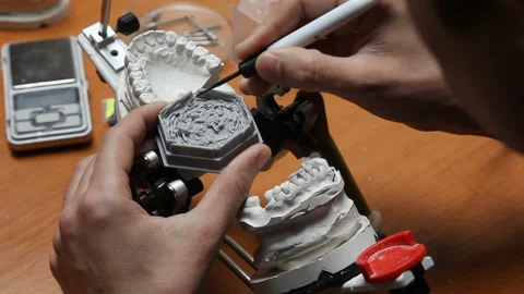 Dental prosthesis, dentures, prosthetics work. Video stock 87395064