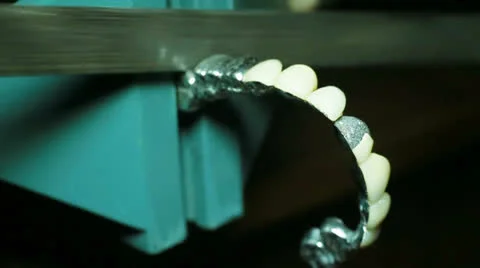 Dental prosthesis Video stock 22916178