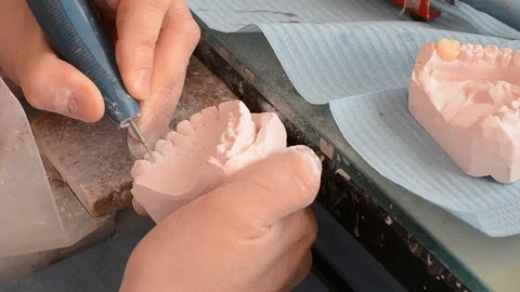 Dental prosthesis Stock Footage 100669129