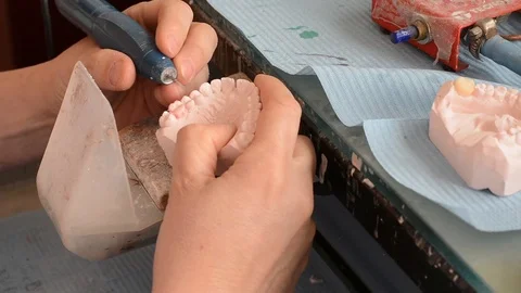 Dental prosthesis Stock Footage 100669282