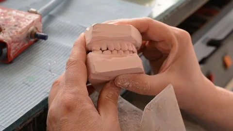 Dental prosthesis Stock Footage 100669406