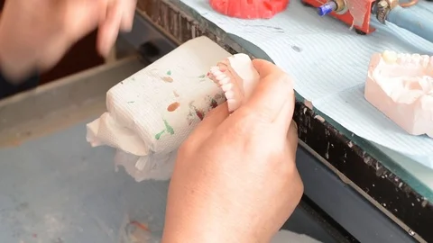 Dental prosthesis Stock Footage 100669424