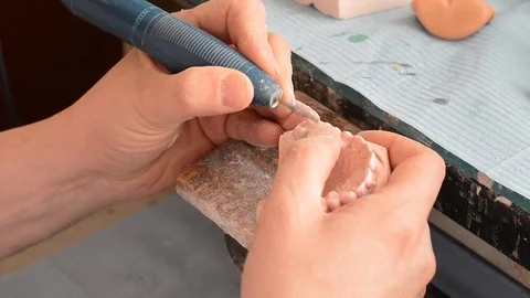 Dental prosthesis Stock Footage 100670587