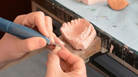 Dental prosthesis Stock Footage 100670729