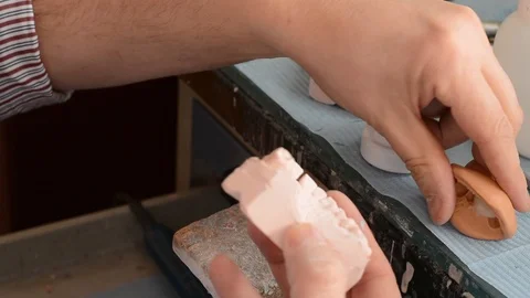 Dental prosthesis Stock Footage 100670752