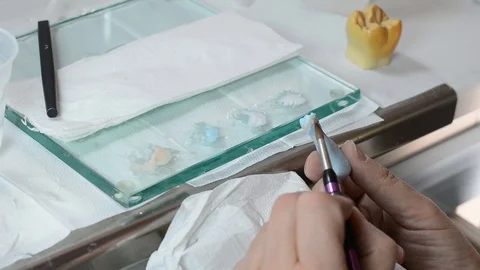 Dental prosthesis Stock Footage 100671308