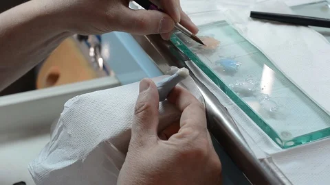 Dental prosthesis Stock Footage 100671449