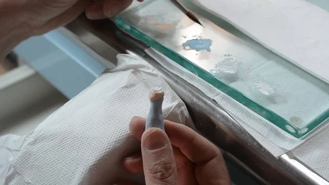 Dental prosthesis Stock Footage 100671702