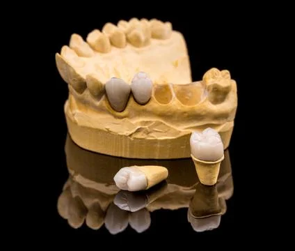 Dental prosthesis Stock Photos