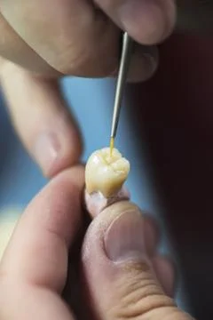 Dental Prosthesis Stock Photos