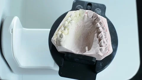 Dental prosthesis scanner Stock Footage 100600963