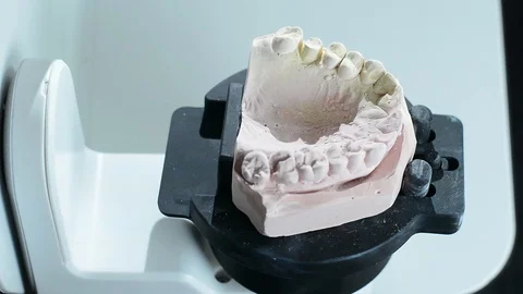 Dental prosthesis scanner Stock Footage 100635609