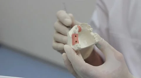 Dental Prosthetic Jaw Stock Footage 62753448