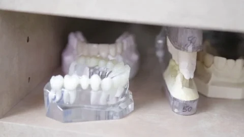 Dental prosthetic teeth Stock Footage 73530763